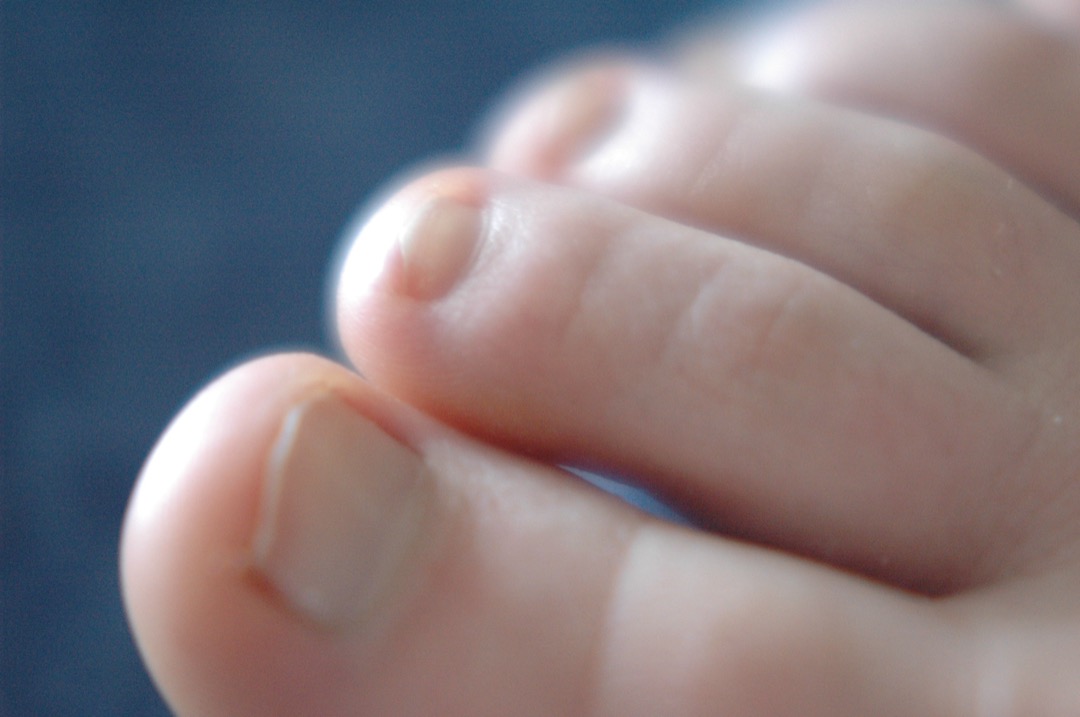 Best toenail fungus treatments of 2026 — OTC antifungal solutions, keratolytic nail renewal liquids, and overnight patches reviewed