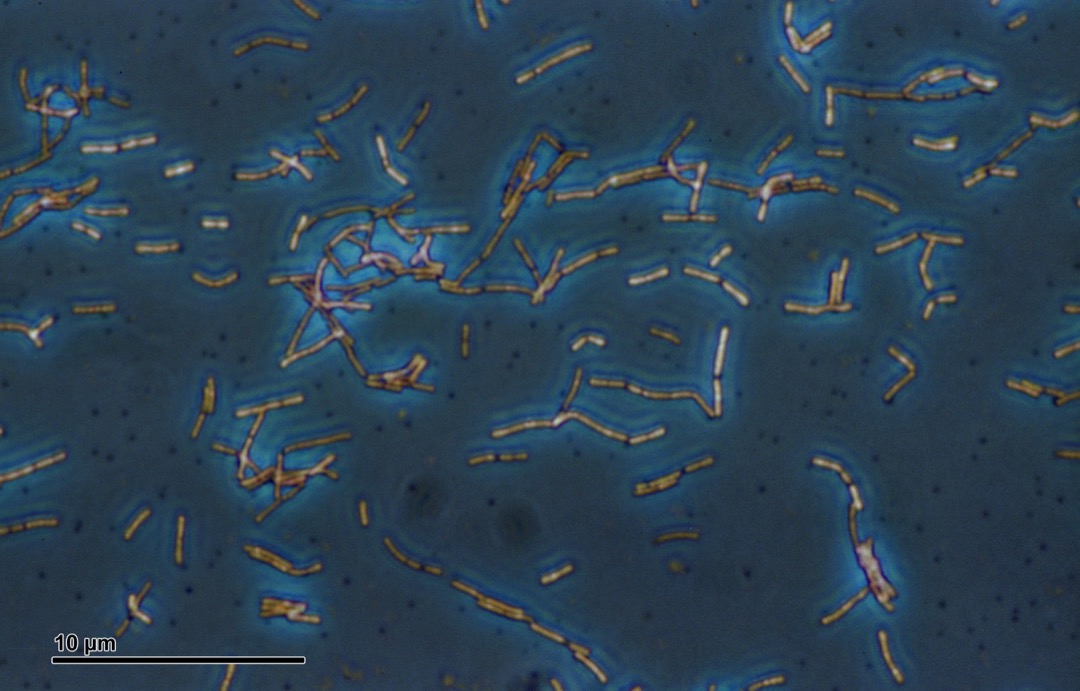 Lactobacillus acidophilus, the Doderlein bacillus that dominates a healthy vaginal microbiome, under phase-contrast microscopy
