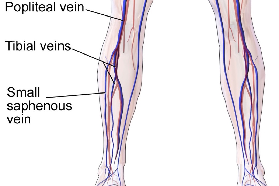 Labeled medical illustration of both lower legs from knee to ankle, showing the popliteal vein behind the knee, the deep tibial veins running inside the calf muscles that the calf muscle pump squeezes, and the small saphenous vein of the superficial system